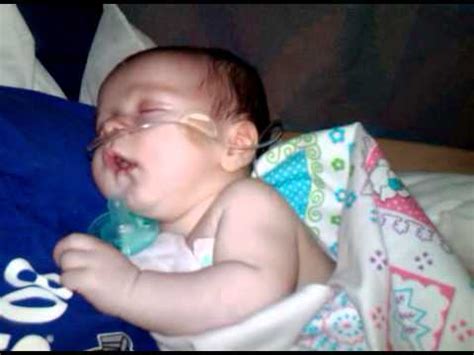 head bobbing in babies.